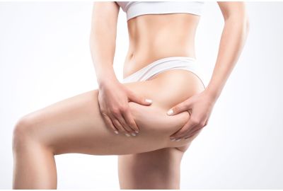 Cellulite? Cause e consigli su come affrontarla